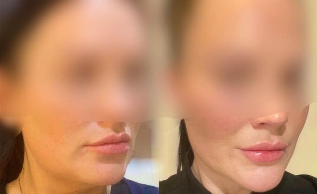 Sydney Cosmetic Clinic | Shop 1/570 New Canterbury Rd, Hurlstone Park NSW 2193, Australia | Phone: 0458 030 177