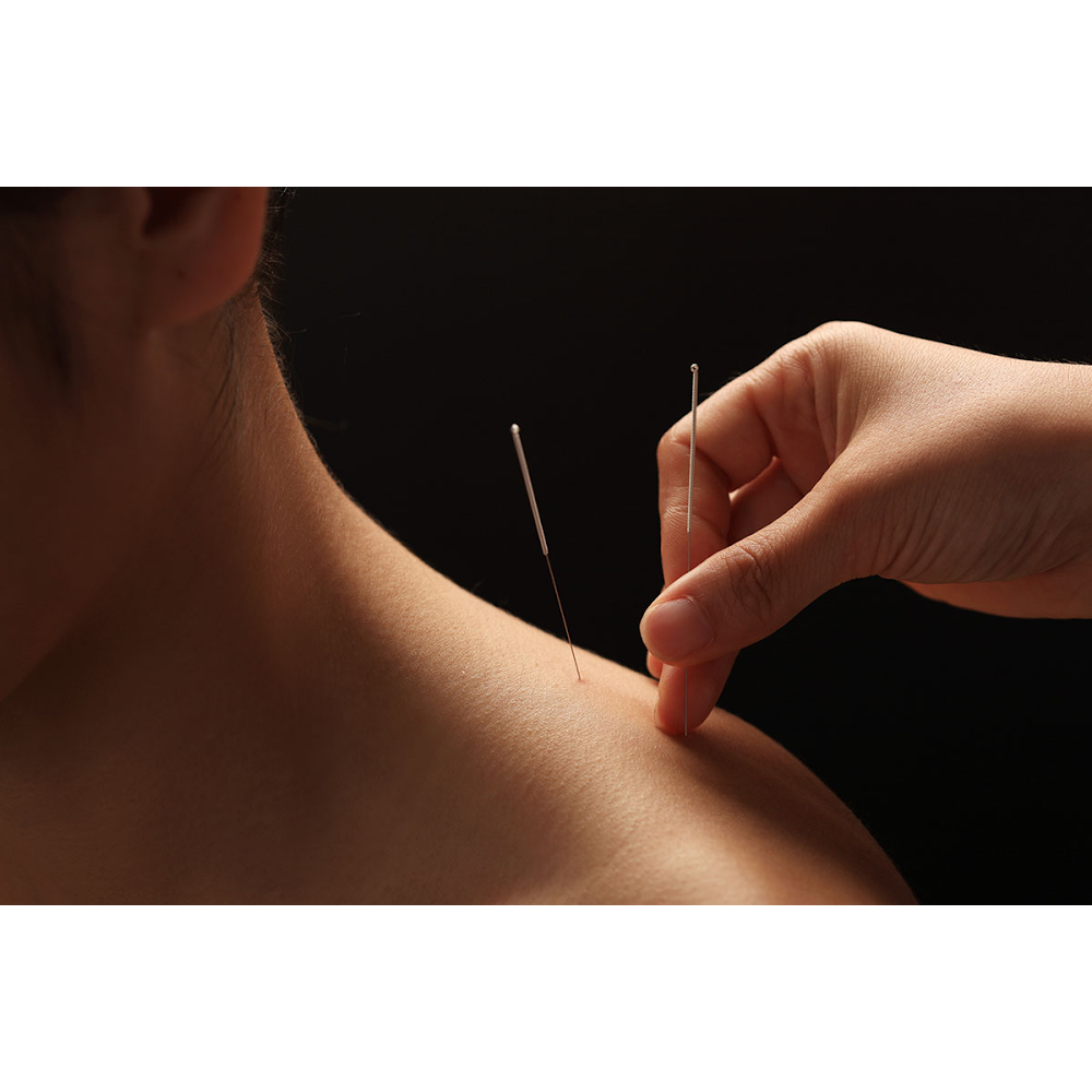 Be Well Acupuncture | 1/16 Lilac St, Inala QLD 4077, Australia | Phone: (07) 3075 6167