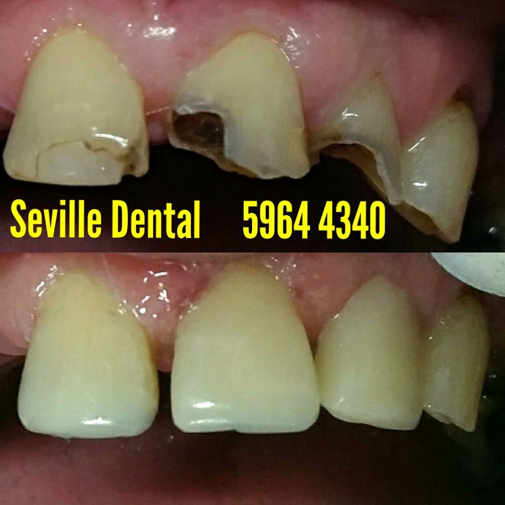 Seville Dental Clinic | dentist | Shop 13/547-567 Warburton Hwy, Seville VIC 3139, Australia | 0359644340 OR +61 3 5964 4340