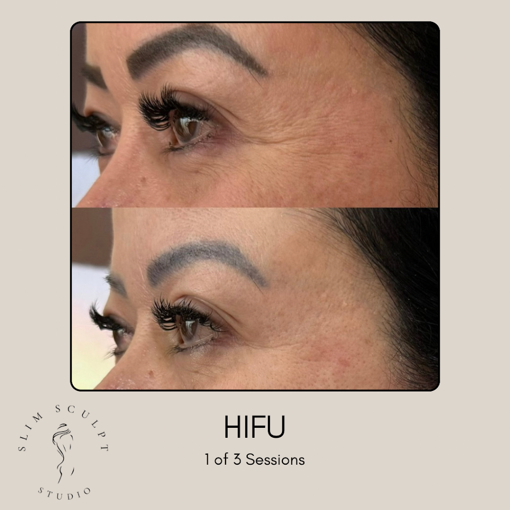 Slim Sculpt Studio | 27 Dilga Cres, Erskine Park NSW 2759, Australia | Phone: 0499 934 410
