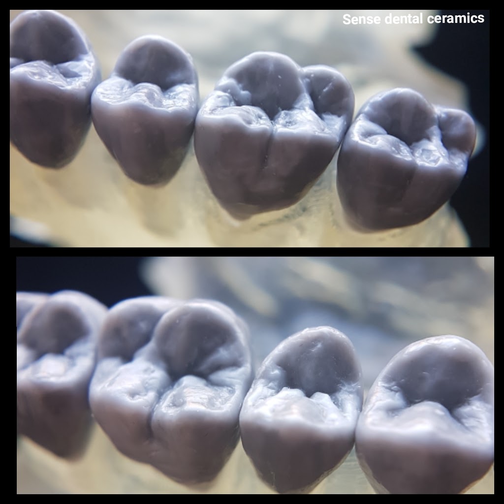 Sense dental ceramics | dentist | 52 Blackcurrant Circuit, Mernda VIC 3754, Australia | 0478111199 OR +61 478 111 199