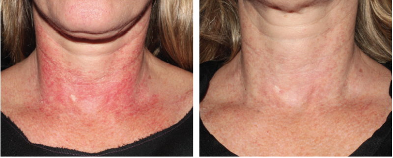 Medical Skin and Laser | doctor | 3/37 Elizabeth St, Kalamunda WA 6076, Australia | 0862931066 OR +61 8 6293 1066