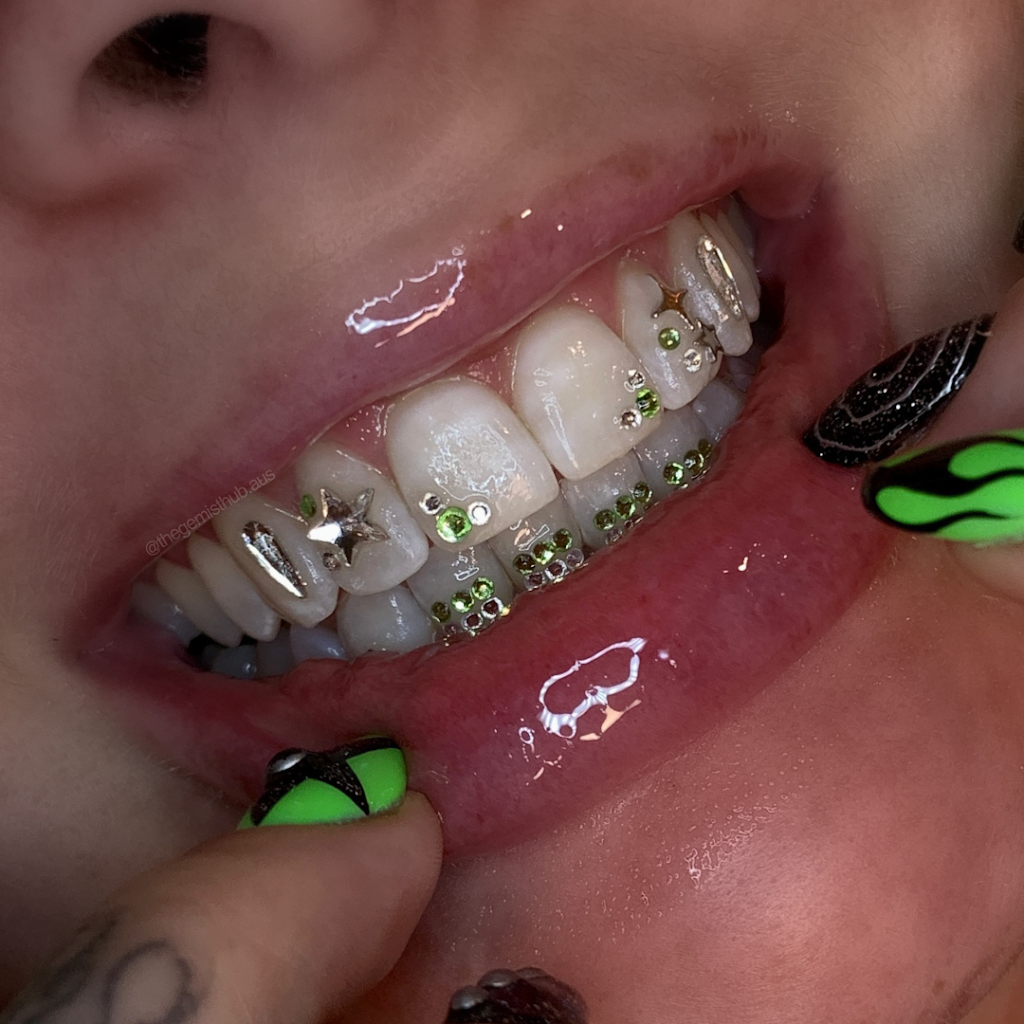 The Gemist Hub | Tooth Gems Sydney | Teeth Whitening Sydney | Vale St, Canley Vale NSW 2166, Australia | Phone: 0416 169 211