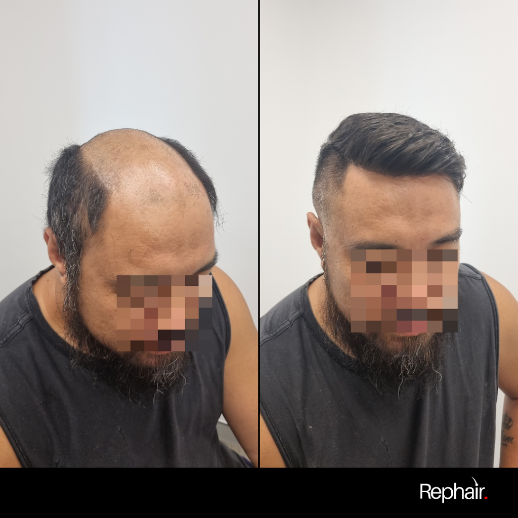 Rephair | 23/58 Riverwalk Ave, Robina QLD 4226, Australia | Phone: 0437 778 852