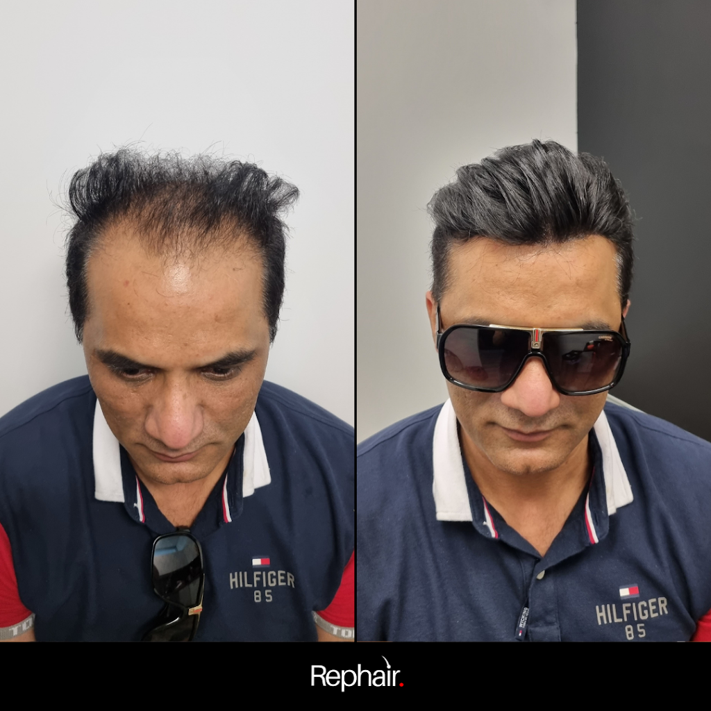 Rephair | 23/58 Riverwalk Ave, Robina QLD 4226, Australia | Phone: 0437 778 852