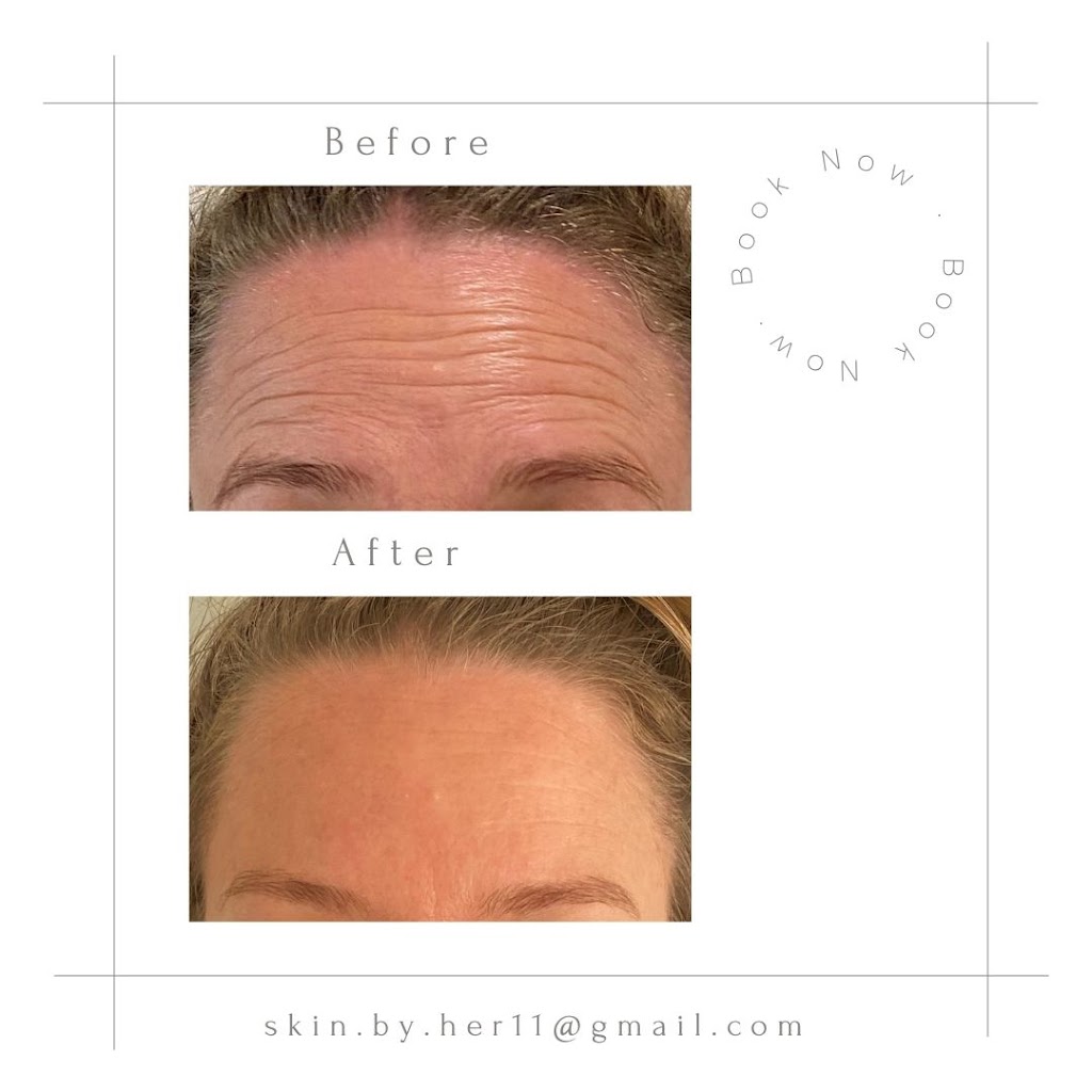 Skin By Her- Devon North | 11 Hobson Ct, Devon North VIC 3971, Australia | Phone: 0400 558 453