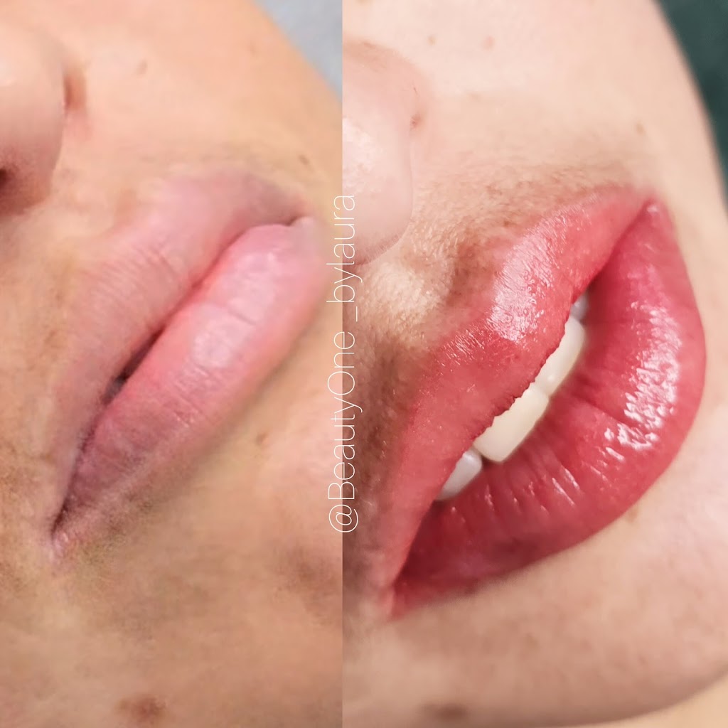 Beauty One | 20 Birdwood St, Denistone East NSW 2111, Australia | Phone: 0449 012 123