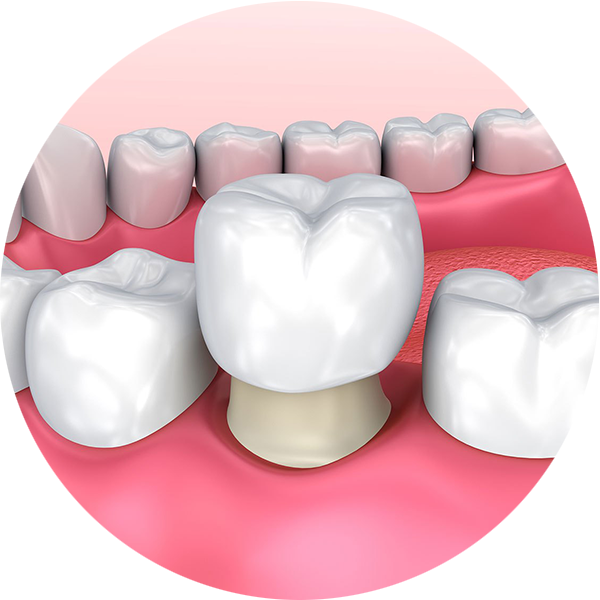 Dental @ Campbelltown | dentist | 523 Lower North East Rd, Campbelltown SA 5074, Australia | 0883658111 OR +61 8 8365 8111