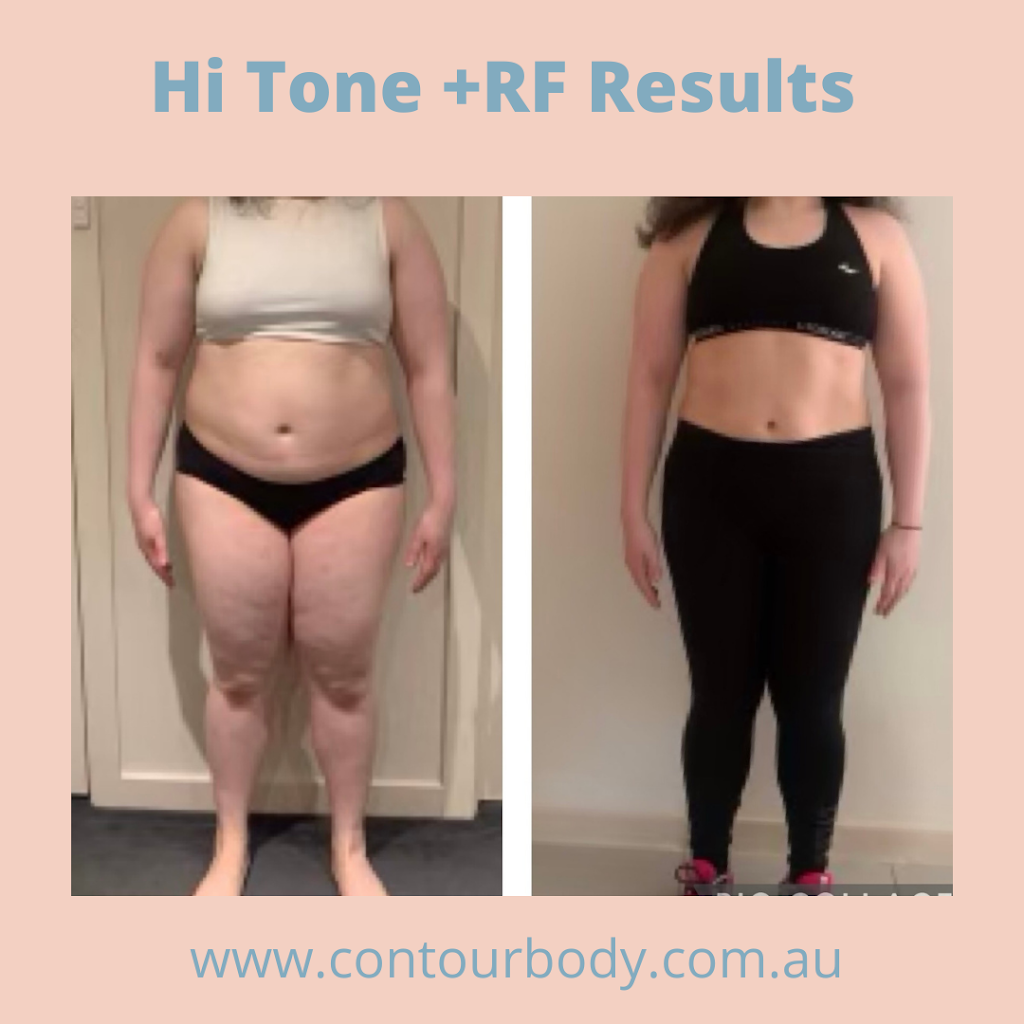 Contour Body Malvern | 413 Waverley Rd, Malvern East VIC 3145, Australia | Phone: 0428 942 075