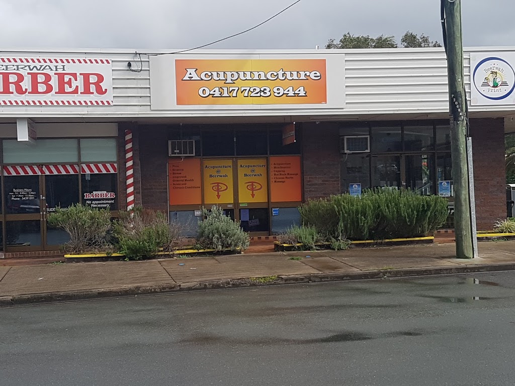 Acupuncture @ Beerwah | health | Shop 1/2 Turner St, Beerwah QLD 4519, Australia | 0754390015 OR +61 7 5439 0015