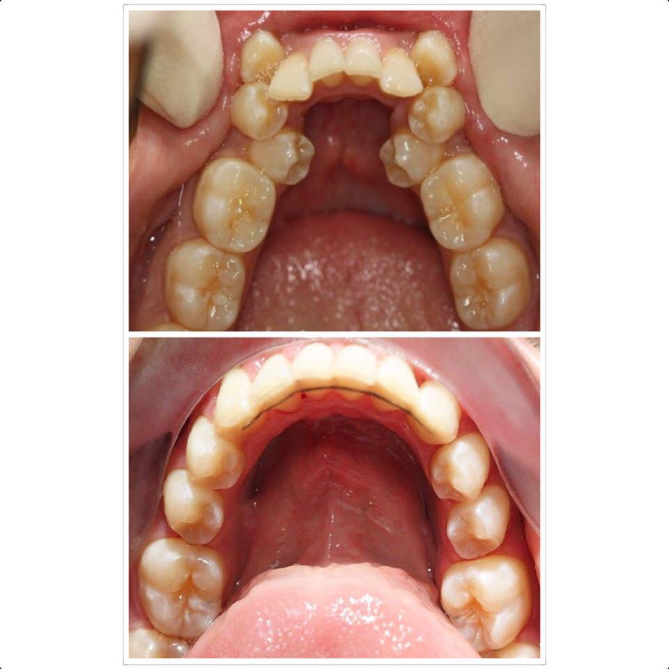 Wangaratta Dental Clinic | dentist | 36a/36B Reid St, Wangaratta VIC 3677, Australia | 0357213763 OR +61 3 5721 3763