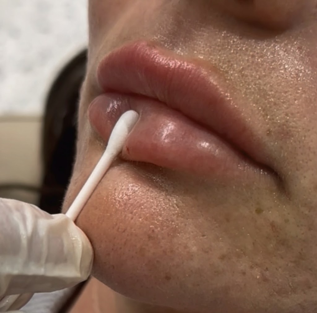 Plump It Up Aesthetics | 1 Greenbridge Dr, Wilton NSW 2571, Australia | Phone: 0467 399 831