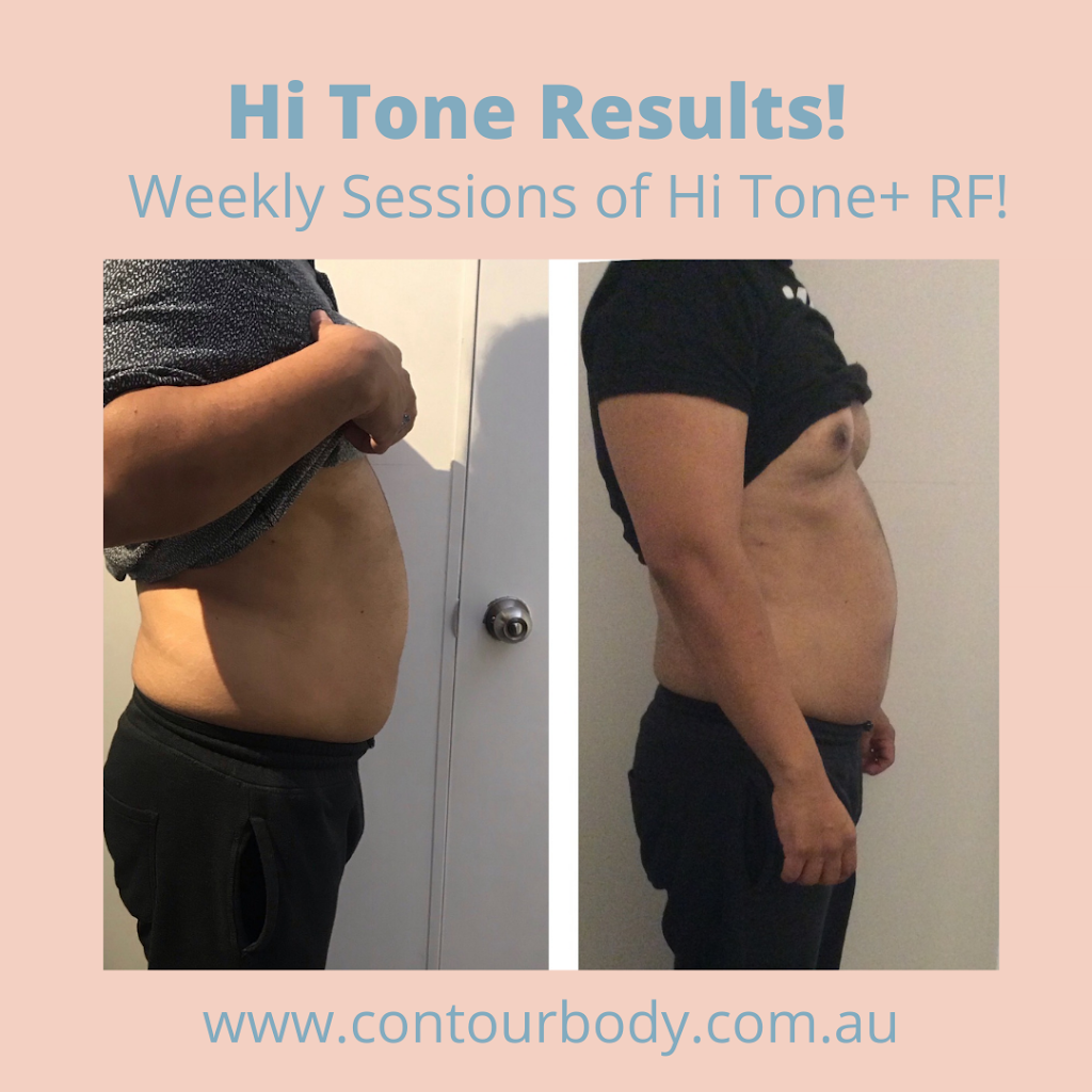 Contour Body Malvern | 413 Waverley Rd, Malvern East VIC 3145, Australia | Phone: 0428 942 075