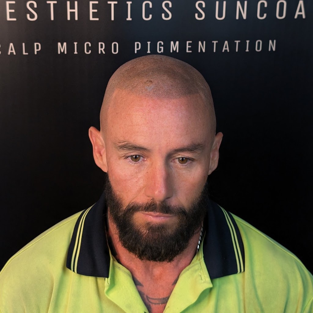 Smp Aesthetics Suncoast | 42 Ngungun Cr, Glass House Mountains QLD 4518, Australia | Phone: 0434 320 318