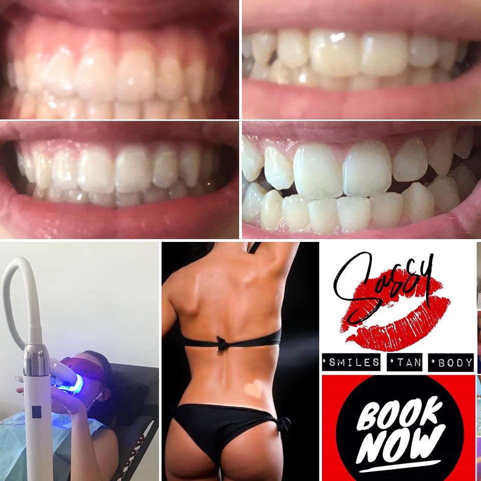 SassyBodyBeauty | dentist | 16A Kenrose St, Carina QLD 4152, Australia | 0417768595 OR +61 417 768 595