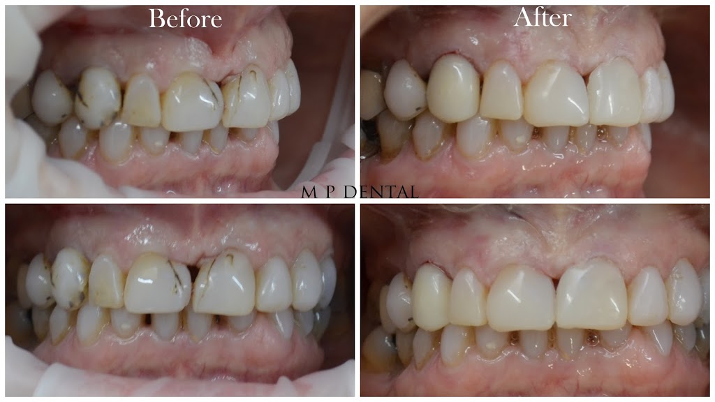 MP Dental Wangaratta | dentist | 47-51 Joyce Way, Wangaratta VIC 3677, Australia | 1800433682 OR +61 1800 433 682