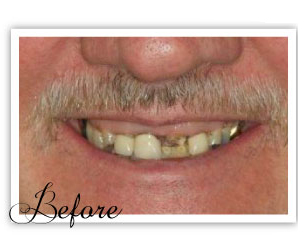 Golden Smile Denture Clinic | health | 8 Meadows Rd, Cabramatta West NSW 2166, Australia | 0297113272 OR +61 2 9711 3272