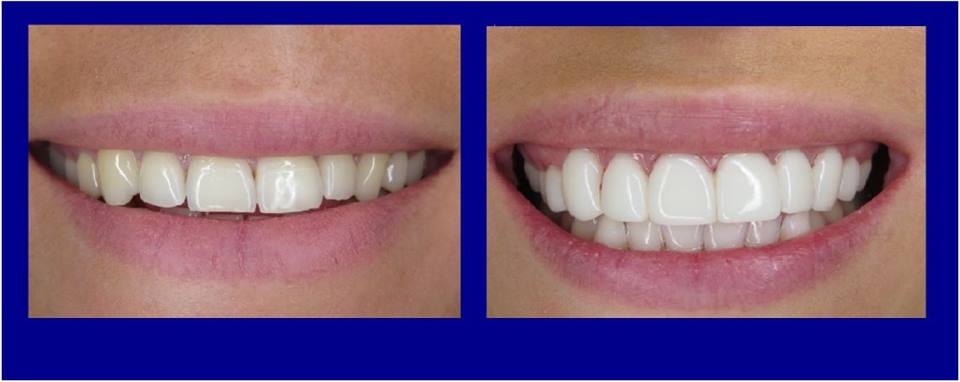 Your Gold Coast Dentist | dentist | Gold Coast Parkwood Piazza, shop 10/300 Olsen Ave, Parkwood QLD 4214, Australia | 0755946699 OR +61 7 5594 6699