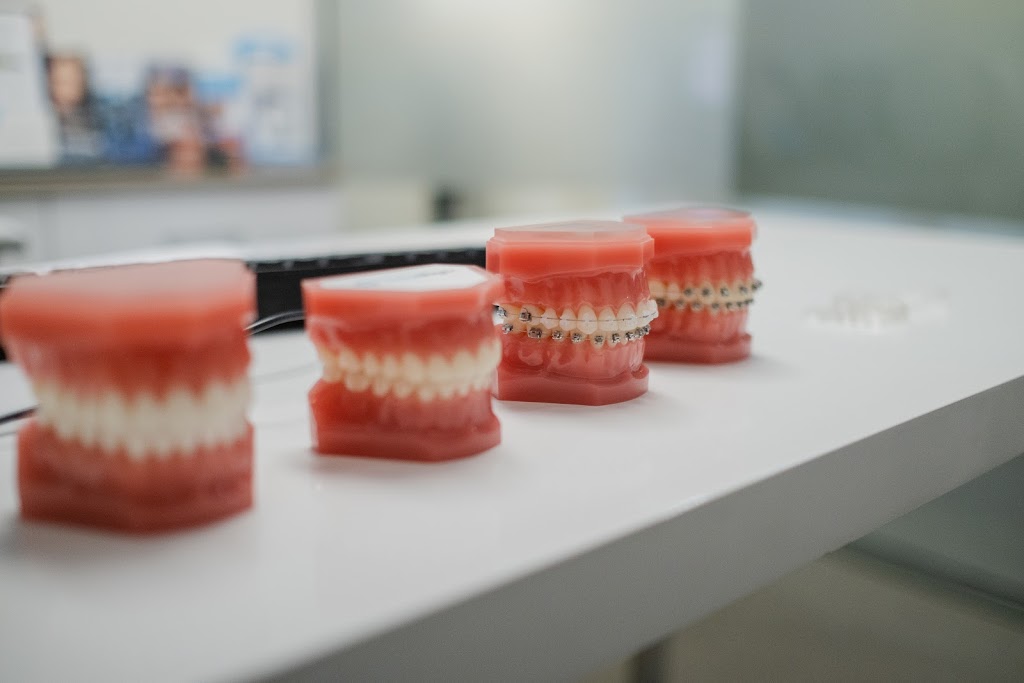 Invisible Orthodontics | dentist | 1/10 Pier St, Urangan QLD 4655, Australia | 0754378080 OR +61 7 5437 8080