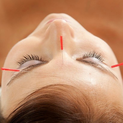 Sakura Acupuncture Clinic | 22 Bushing St, Wynnum West QLD 4178, Australia | Phone: 0413 534 665