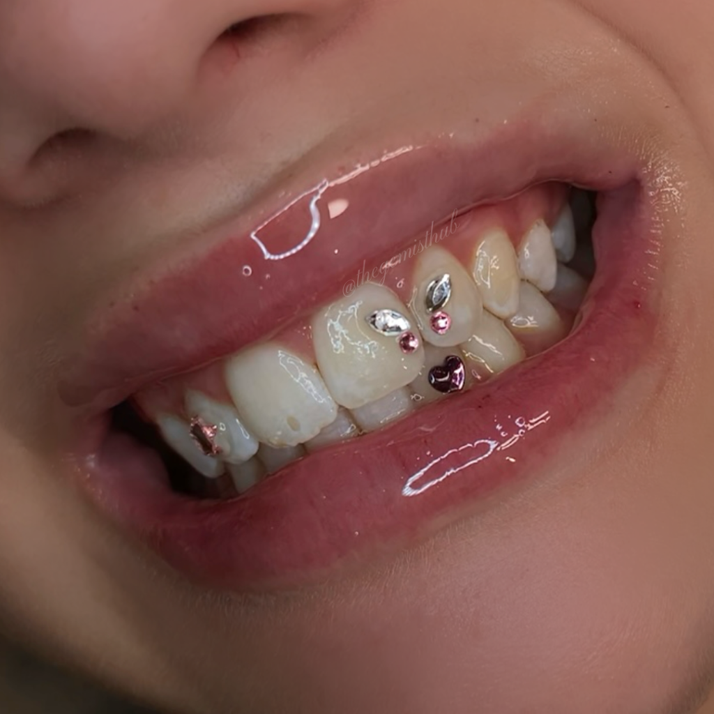 The Gemist Hub | Tooth Gems Sydney | Teeth Whitening Sydney | Vale St, Canley Vale NSW 2166, Australia | Phone: 0416 169 211