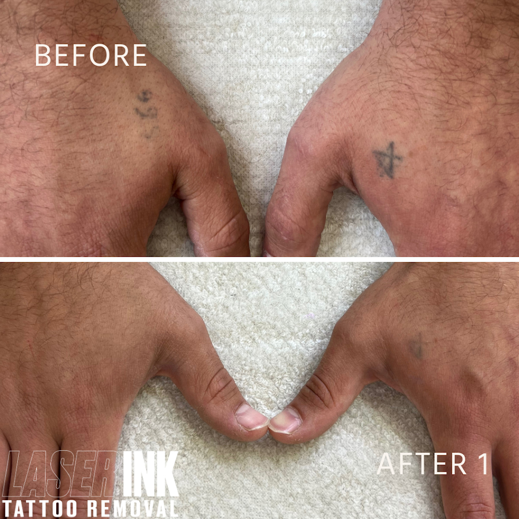 Laser Ink | 11/260 Captain Cook Dr, Kurnell NSW 2331, Australia | Phone: 0413 850 148