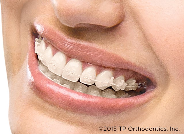 TP Orthodontics Australia Pty Ltd | health | 6/369 Royal Parade, Parkville VIC 3052, Australia | 1800643055 OR +61 1800 643 055