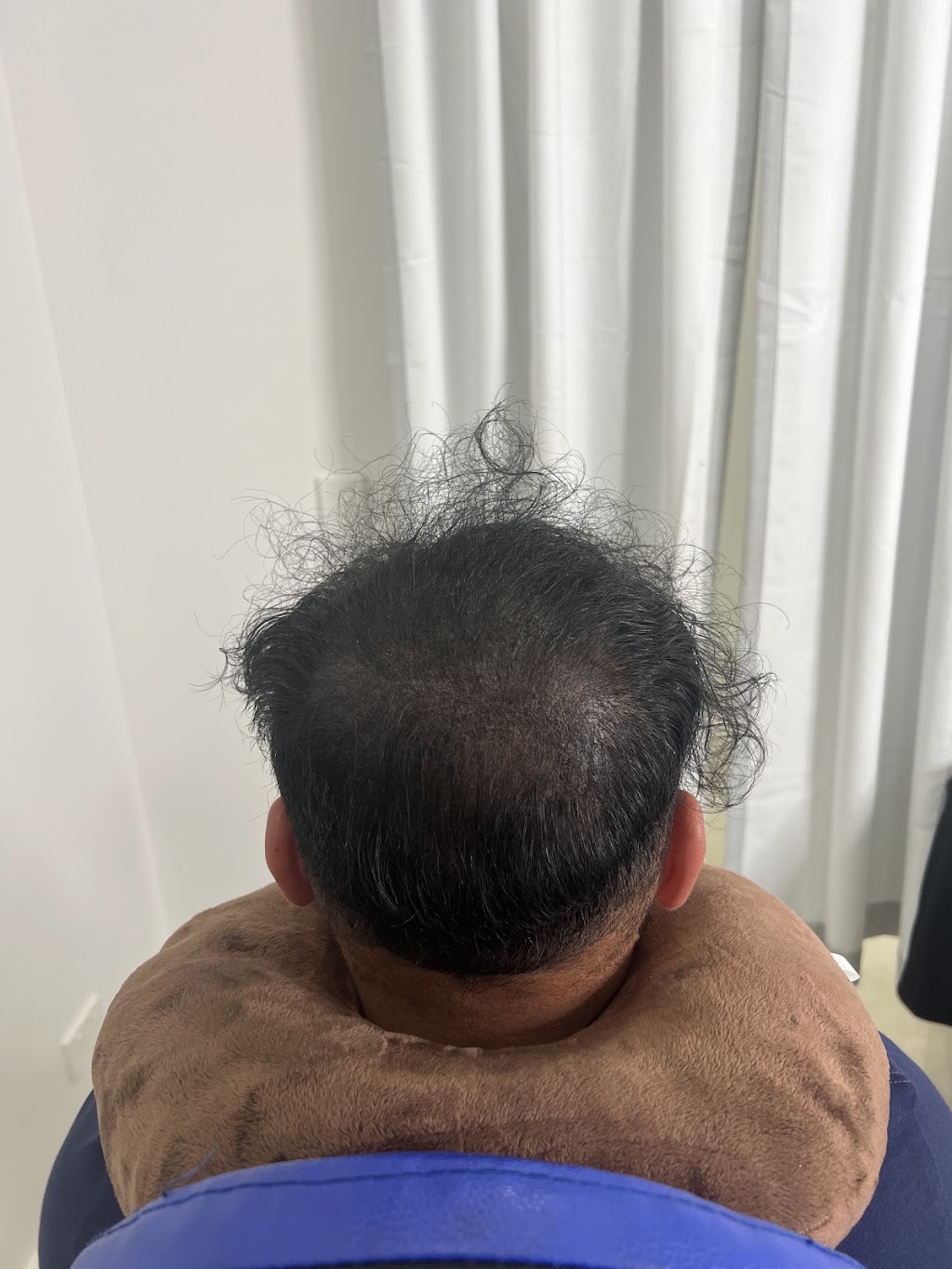 Scalp It SMP Hair Clinic | 11 - 13 Main St, Mount Annan NSW 2567, Australia | Phone: 0405 222 339