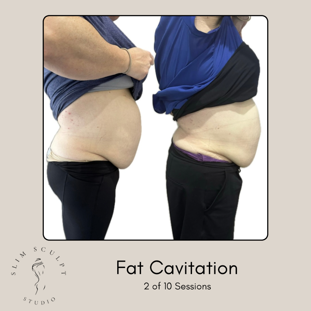 Slim Sculpt Studio | 27 Dilga Cres, Erskine Park NSW 2759, Australia | Phone: 0499 934 410