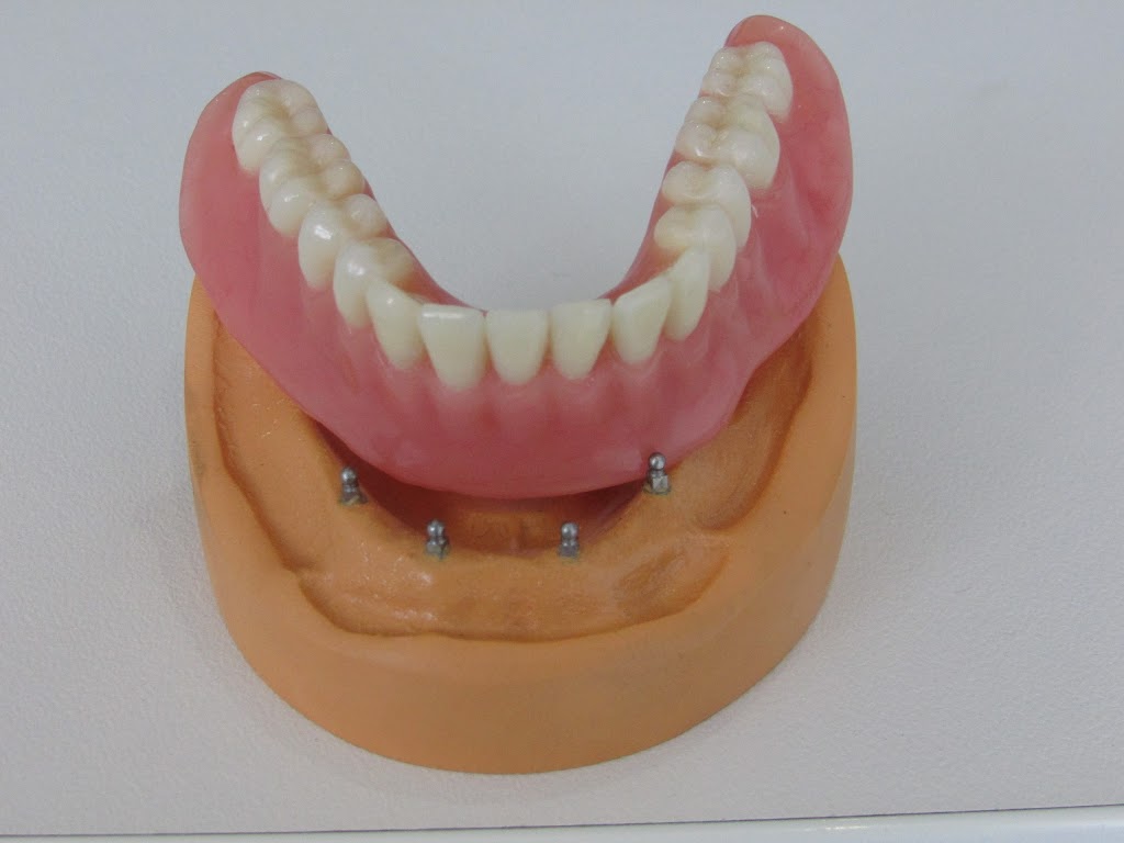 Everlasting Smiles Dental | dentist | 6/634 Gympie Rd, Chermside QLD 4032, Australia | 0738615006 OR +61 7 3861 5006
