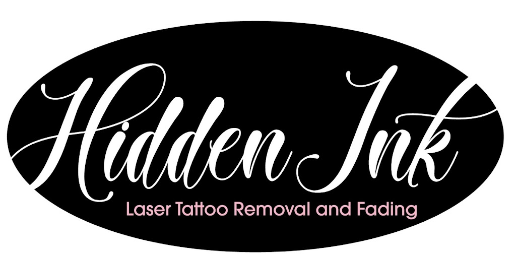 Hidden Ink Laser Tattoo Removal Wagga |  | 407 Hampden Ave, Cartwrights Hill NSW 2650, Australia | 0429464834 OR +61 429 464 834