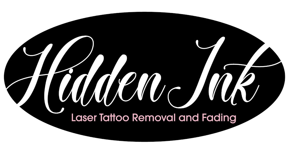 Hidden Ink Laser Tattoo Removal Wagga | 407 Hampden Ave, Cartwrights Hill NSW 2650, Australia | Phone: 0429 464 834