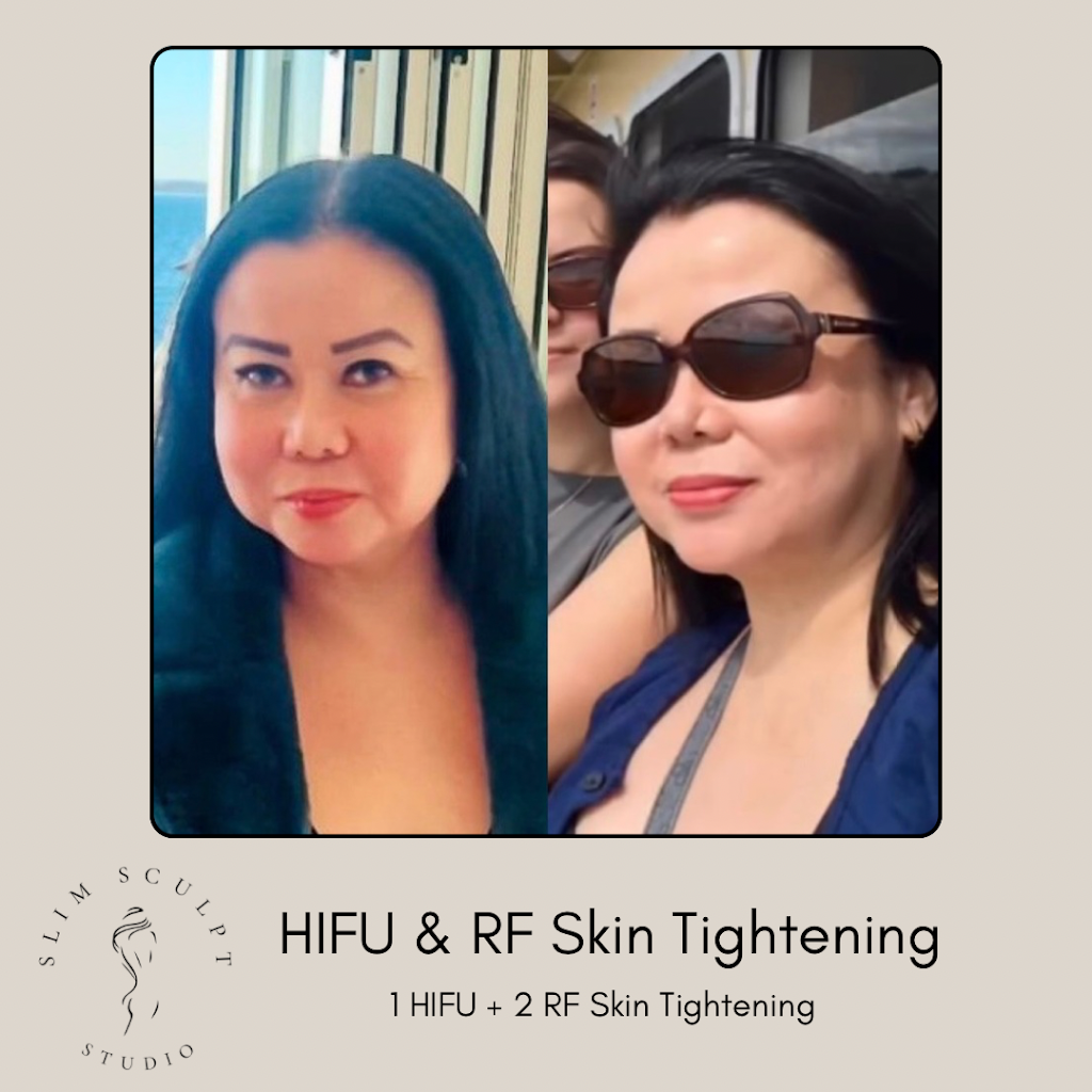 Slim Sculpt Studio | 27 Dilga Cres, Erskine Park NSW 2759, Australia | Phone: 0499 934 410