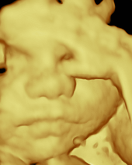 Newcrest Baby Imaging - 3D Baby Ultrasound Scans, Newcastle, NSW | health | 26 Pinchtail St, Chisholm NSW 2322, Australia | 0497077481 OR +61 497 077 481