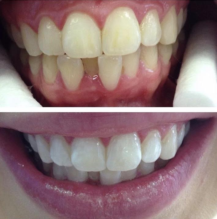 Smile Labs Albury | dentist | 7/525 David St, Albury NSW 2640, Australia | 0260415701 OR +61 2 6041 5701