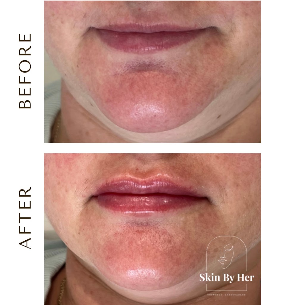 Skin By Her- Devon North | 11 Hobson Ct, Devon North VIC 3971, Australia | Phone: 0400 558 453