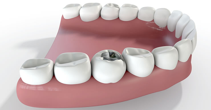eDental Perth | Eastgate Commercial Centre, 14/49 Great Eastern Hwy, Rivervale WA 6103, Australia | Phone: 1300 467 112
