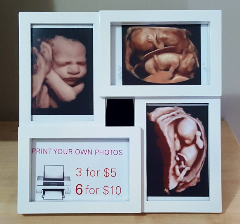 Baby Ultrasound Studio | health | 109 Glenfields Blvd, Mountain Creek QLD 4557, Australia | 0455554420 OR +61 455 554 420