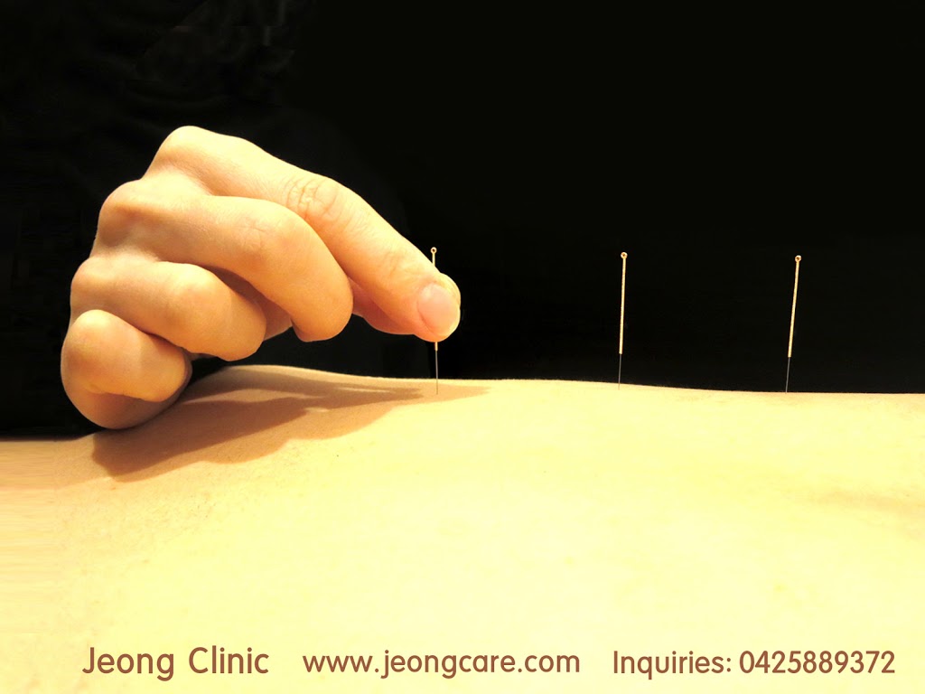 Jeong Clinic - Wolli Creek Acupuncture & Herbs | health | 1/7 Magdalene Terrace, Wolli Creek NSW 2205, Australia | 0425889372 OR +61 425 889 372