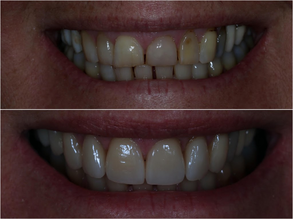 Chesterville Dental | dentist | 318 Chesterville Rd, Bentleigh East VIC 3165, Australia | 0395707962 OR +61 3 9570 7962