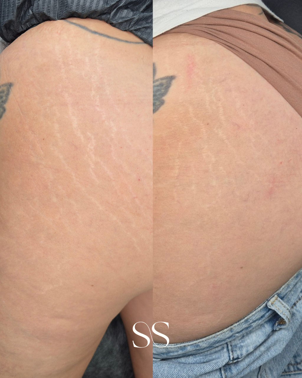 Second Skin By Lauren | 5/141 Maudsland Rd, Oxenford QLD 4210, Australia | Phone: 0480 735 455