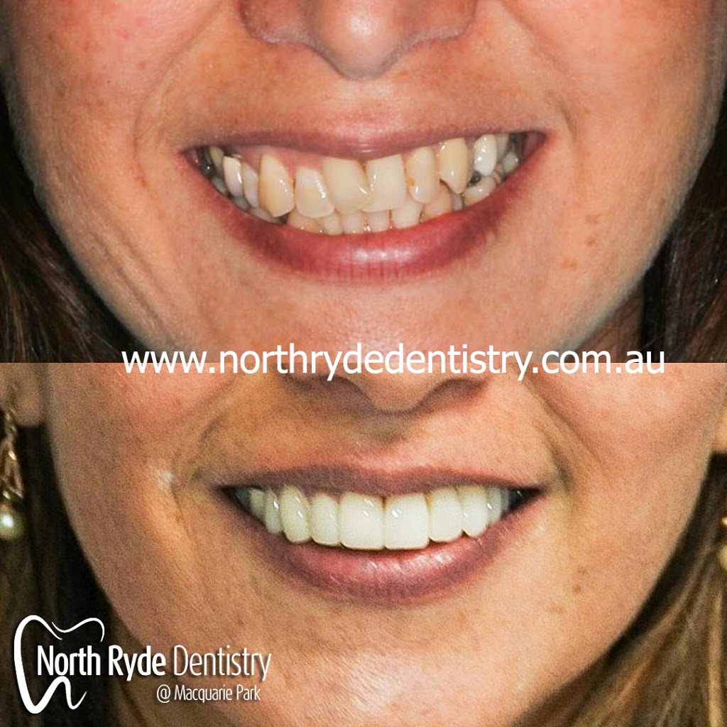North Ryde Dentistry | B, 4/64 Talavera Rd, Macquarie Park NSW 2113, Australia | Phone: (02) 8090 1102