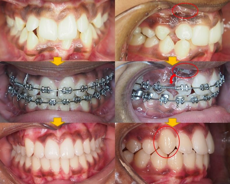 eDentistry Wantirna (Dr Alex Loh) | dentist | 271 Stud Rd, Wantirna South VIC 3152, Australia | 0398001184 OR +61 3 9800 1184