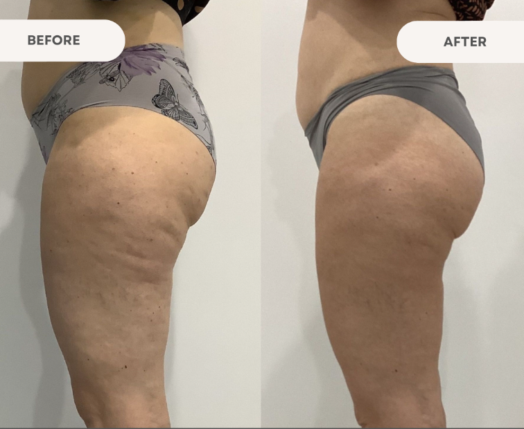 Elite Contours Body Sculpting & Aestheticians Academy | 3 Lymington Rd, Cygnet TAS 7112, Australia | Phone: 0447 840 616