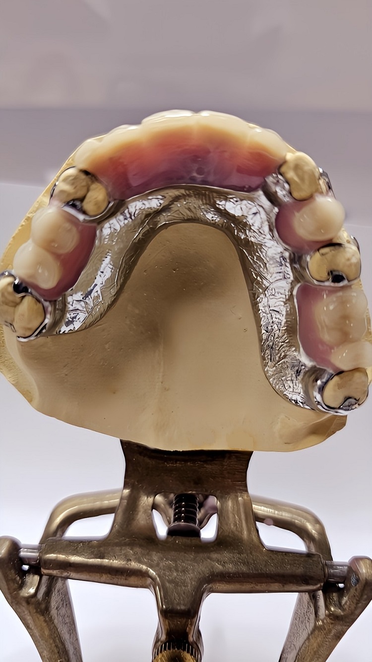 Hill End Dental Laboratory | 8 Majors Ave, Colebee NSW 2761, Australia | Phone: 0410 112 083