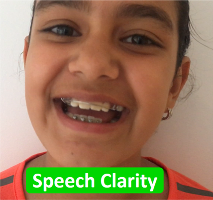 Super Speak Public Speaking Classes For Kids | 44 Station St, Burwood VIC 3125, Australia | Phone: (03) 9572 5249