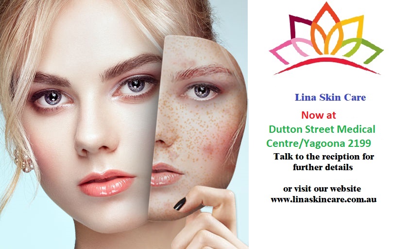 Lina Skin Care | 124-132 Dutton St, Yagoona NSW 2199, Australia | Phone: 0416 968 944