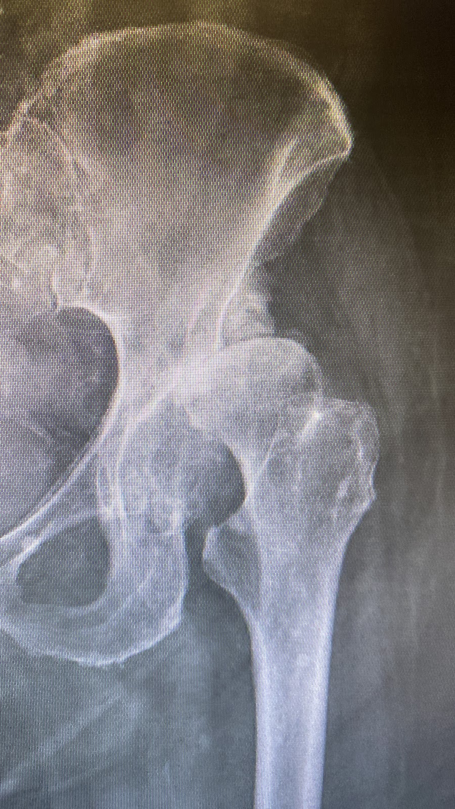Westgippsland Orthopaedics | 41 Landsborough St, Warragul VIC 3820, Australia | Phone: (03) 5623 0810
