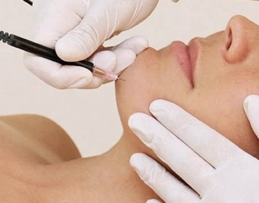 Rae of beauty electrolysis clinic | 78 Boomi Ave, South Maclean QLD 4280, Australia | Phone: 0493 367 666 Rae of beauty electrolysis clinic | 78 Boomi Ave, South Maclean QLD 4280, Australia | Phone: 0493 367 666