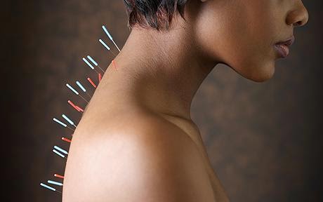 Chinese Acupuncture Clinic & Body Piercing | 99 Council Ave, Rockingham WA 6168, Australia | Phone: (08) 9592 2272